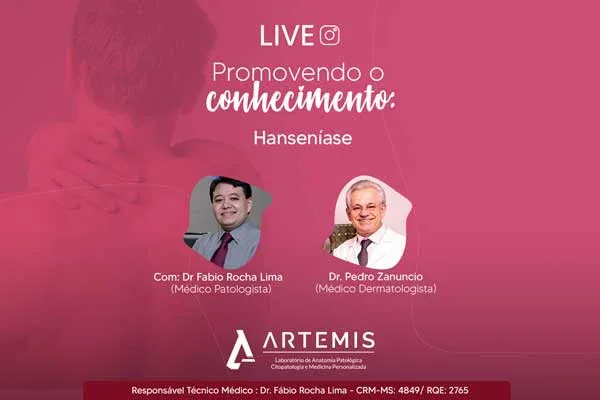 Hanseníase