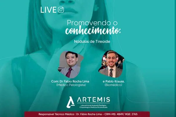 Nódulos de tireoide