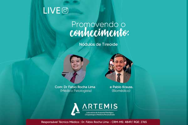 nodulos de tireooide