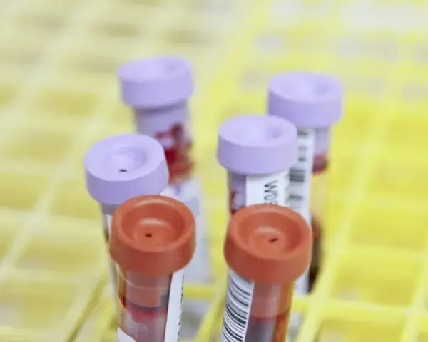 Urina, Fezes e Função Renal